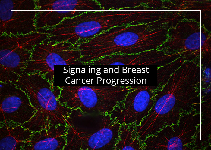 Signaling and Breast Cancer Progression